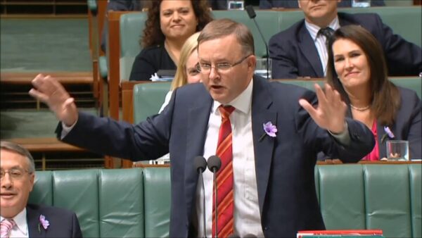 Tony Abbot and the Vuvuzela