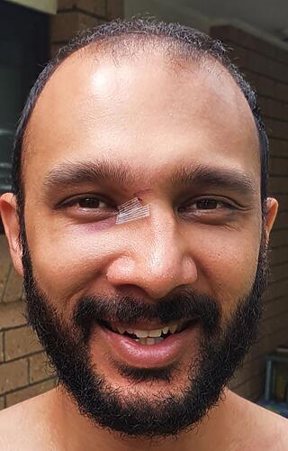 Jonathan Sriranganathan, Councillor for The Gabba was assaulted last w...
