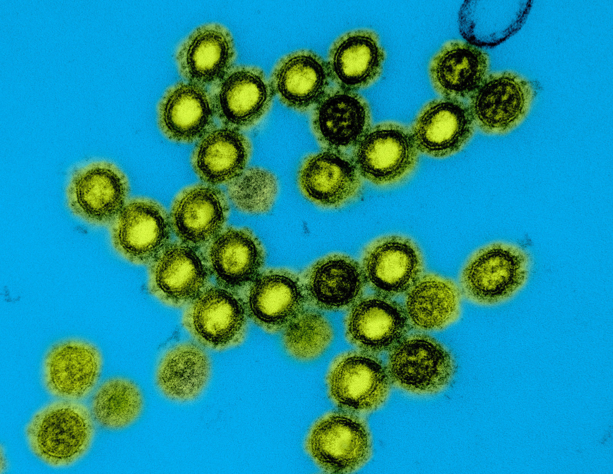 HHS, NIH Unveil Next-Gen Universal Vaccine Platform