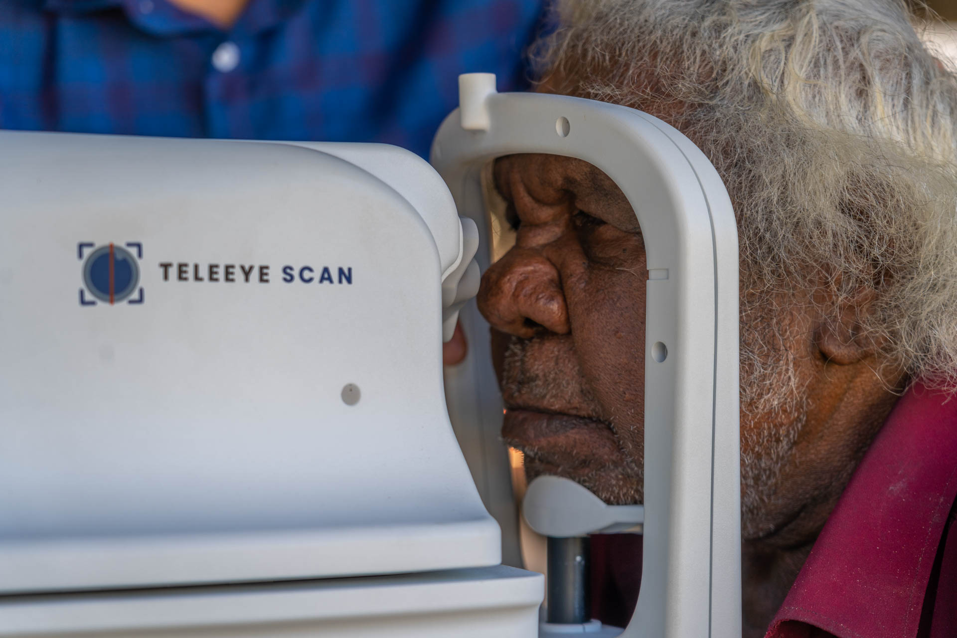 AI Tech Bridges Indigenous Healthcare Gap