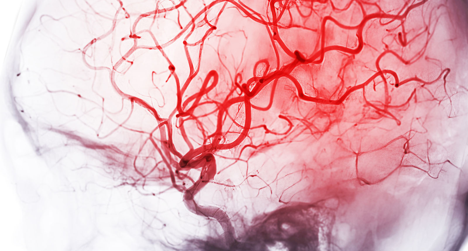 Breakthrough in Brain Scans, Neurodegeneration Insight