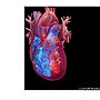 Low-Dose Weight Loss Drug Eases Heart Failure Signs