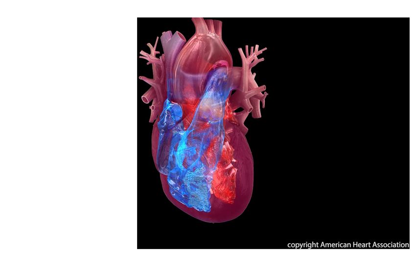 Low-Dose Weight Loss Drug Eases Heart Failure Signs
