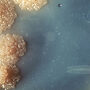 Research: Tailor Treatment to Disease Severity