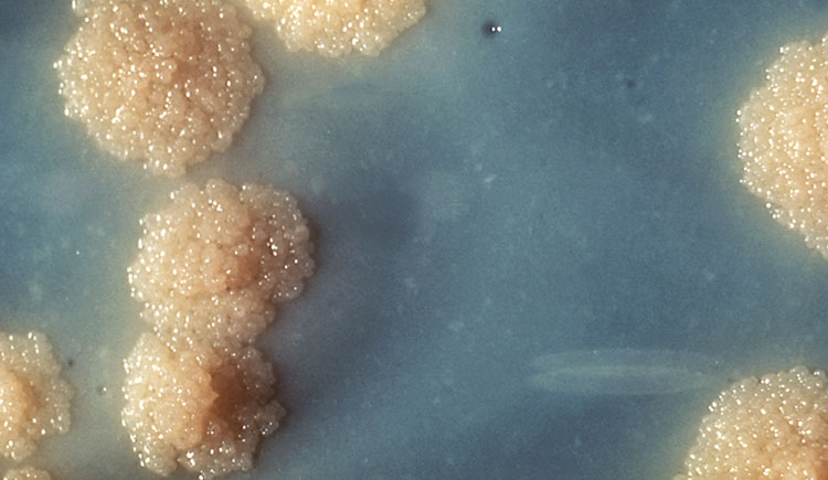 Research: Tailor Treatment to Disease Severity