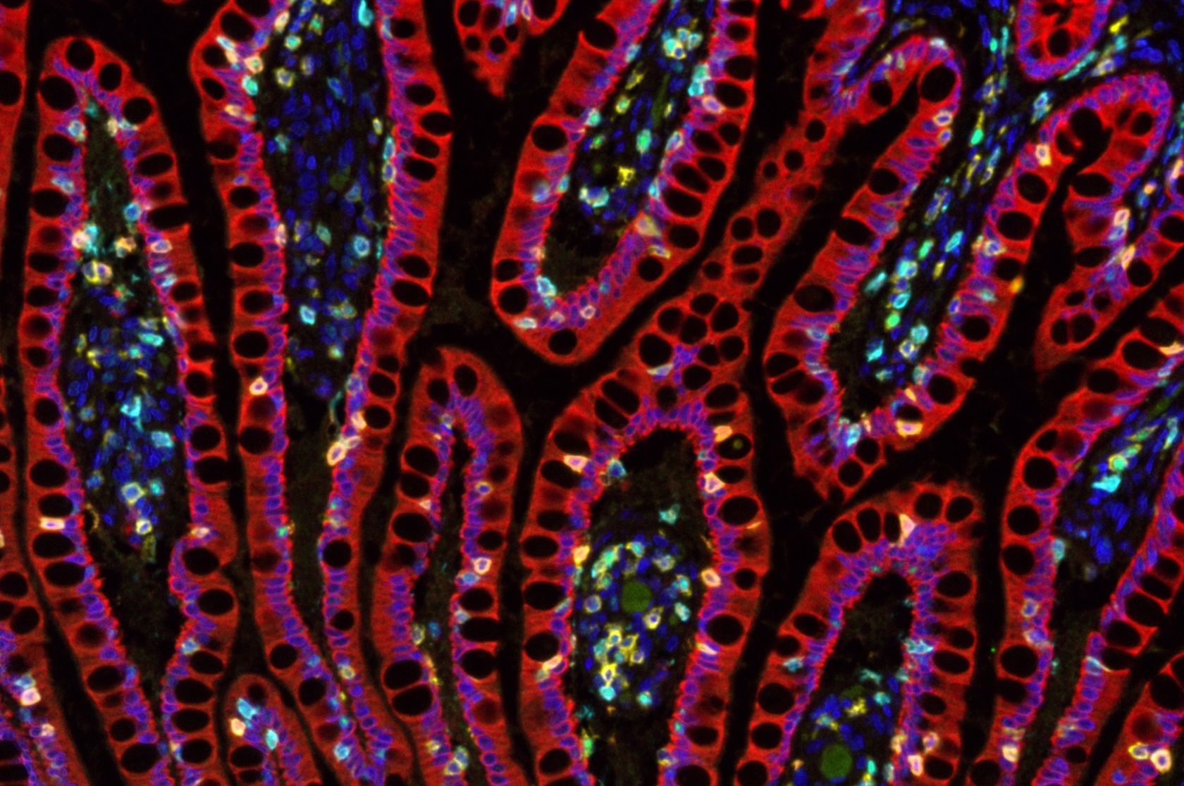 Researchers Awarded $4.5m ARC Future Fellowships
