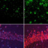 Lithium Loss Triggers Alzheimer's, Compound Reverses It