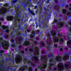 Sensory Cells Curb Harmful Immune Responses