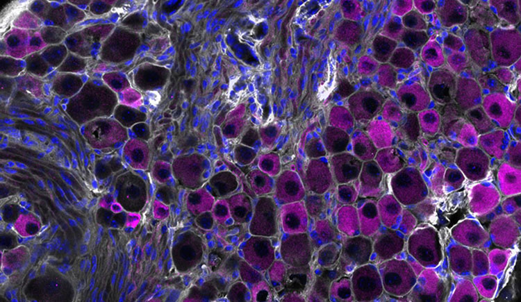 Sensory Cells Curb Harmful Immune Responses